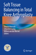 Soft Tissue Balancing in Total Knee Arthroplasty 2017