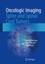 Oncologic Imaging: Spine and Spinal Cord Tumors 2017