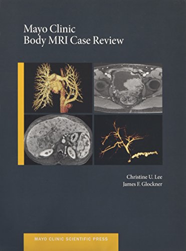 بررسی مورد MRI بدن در کلینیک مایو
