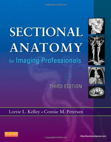 Sectional Anatomy for Imaging Professionals 2013