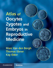 Atlas of Oocytes, Zygotes and Embryos in Reproductive Medicine Hardback with CD-ROM 2012
