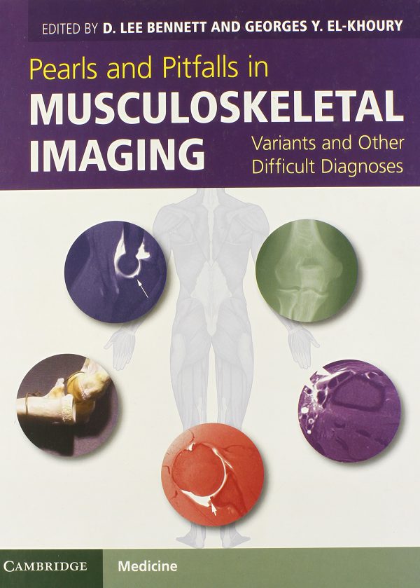 Pearls and Pitfalls in Musculoskeletal Imaging: Variants and Other Difficult Diagnoses 2013