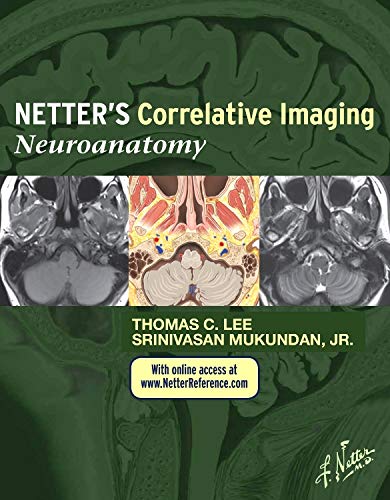 Netter's Correlative Imaging: Neuroanatomy 2014
