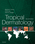 Tropical Dermatology E-Book 2016
