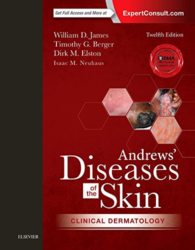 بیماری های پوست اندروز: درماتولوژی بالینی