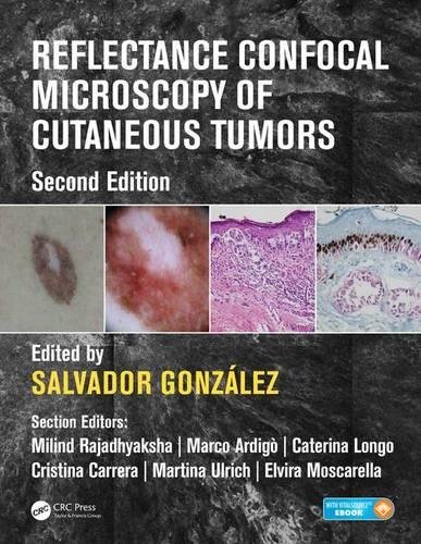 Reflectance Confocal Microscopy of Cutaneous Tumors 2017