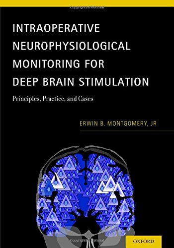 Intraoperative Neurophysiological Monitoring for Deep Brain Stimulation: Principles, Practice, and Cases 2014