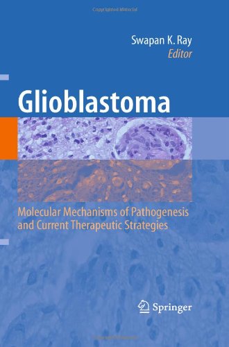 گلیوبلاستوما: مکانیسم های مولکولی پاتوژنز و استراتژی های درمانی فعلی