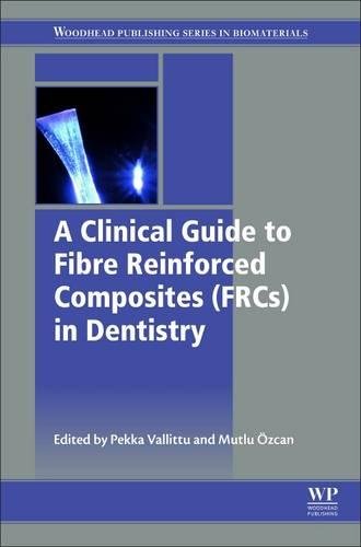 Clinical Guide to Principles of Fiber-Reinforced Composites in Dentistry 2017