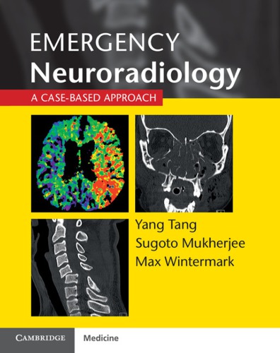 Emergency Neuroradiology: A Case-Based Approach 2015