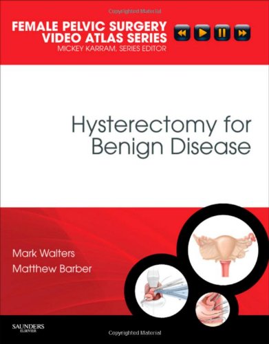 Hysterectomy for Benign Disease 2010
