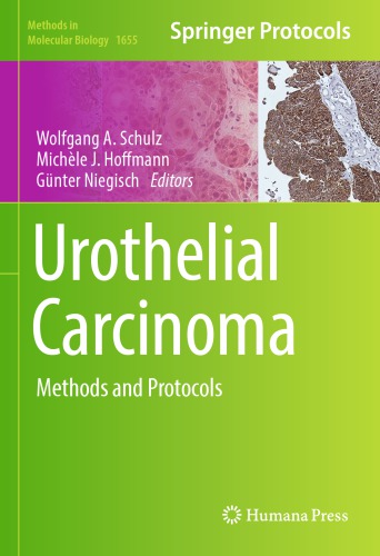 Urothelial Carcinoma: Methods and Protocols 2017