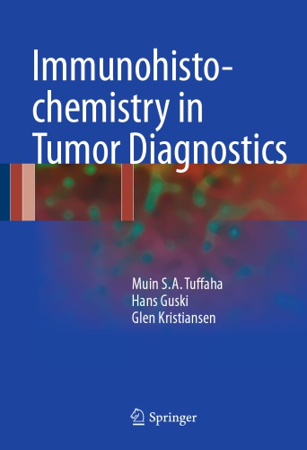 Immunohistochemistry in Tumor Diagnostics 2017