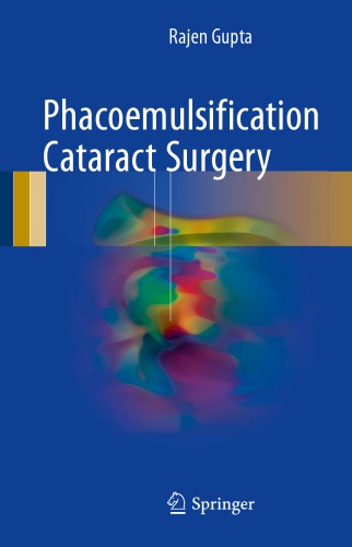 Phacoemulsification Cataract Surgery 2017
