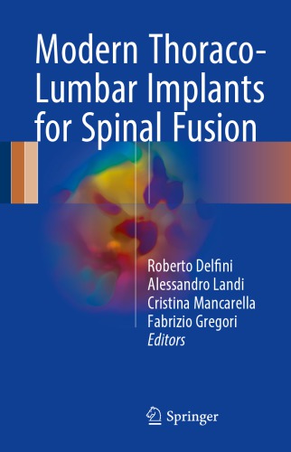 Modern Thoraco-Lumbar Implants for Spinal Fusion 2017