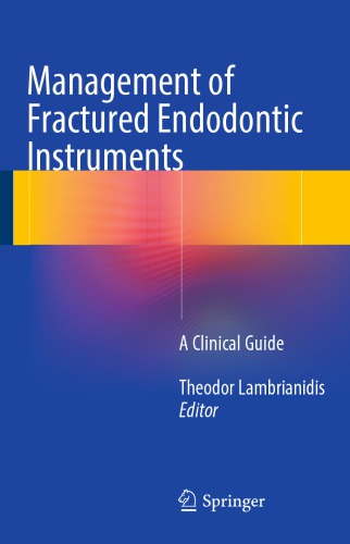Management of Fractured Endodontic Instruments: A Clinical Guide 2017