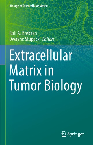 Extracellular Matrix in Tumor Biology 2017