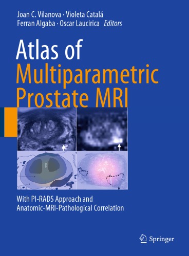 اطلس MRI چند پارامتری پروستات: با رویکرد PI-RADS و همبستگی آناتومیک-MRI-پاتولوژیک.