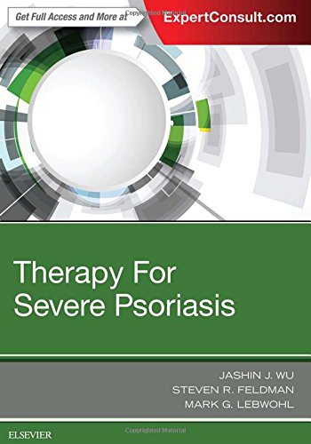 Therapy for Severe Psoriasis 2016