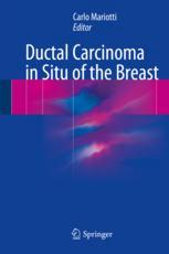 Ductal Carcinoma in Situ of the Breast 2017