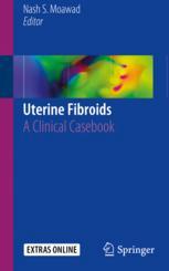 Uterine Fibroids: A Clinical Casebook 2017