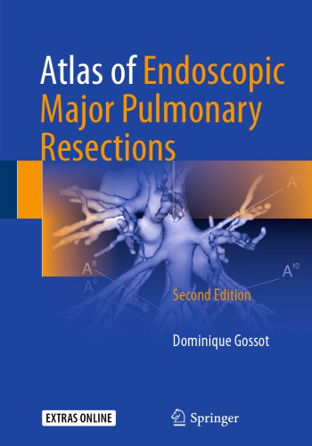 Atlas of Endoscopic Major Pulmonary Resections 2017