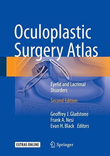 Oculoplastic Surgery Atlas: Eyelid and Lacrimal Disorders 2018