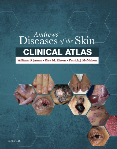 Andrews' Diseases of the Skin Clinical Atlas E-Book: Expert Consult 2016