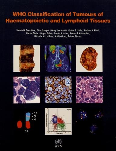 WHO Classification of Tumours of Haematopoietic and Lymphoid Tissues 2017