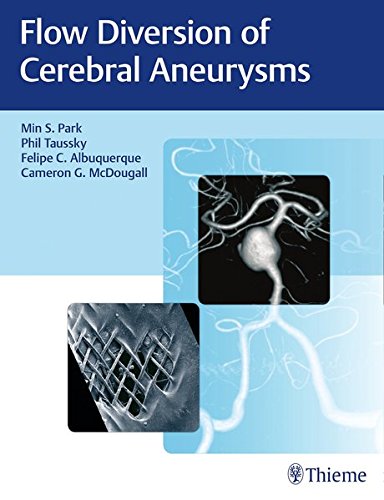 Flow Diversion of Cerebral Aneurysms 2017