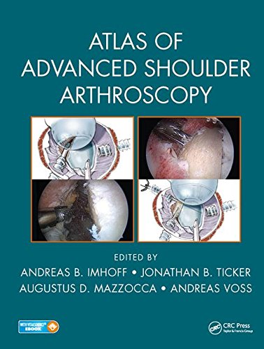 Atlas of Advanced Shoulder Arthroscopy 2018