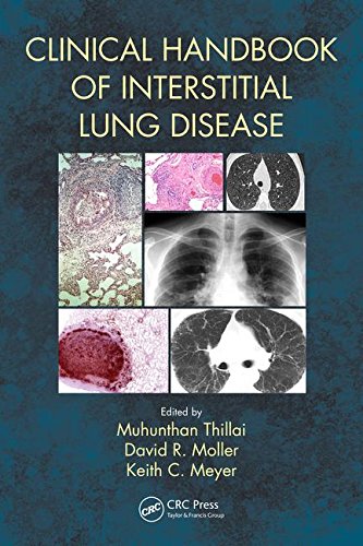 Clinical Handbook of Interstitial Lung Disease 2017