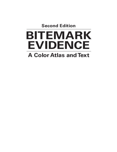 Bitemark Evidence: A Color Atlas and Text, 2nd Edition 2011