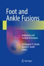 Foot and Ankle Fusions: Indications and Surgical Techniques 2017