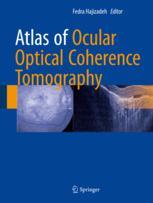 Atlas of Ocular Optical Coherence Tomography 2018
