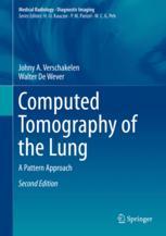 Computed Tomography of the Lung: A Pattern Approach 2018