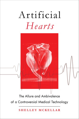 Artificial Hearts: The Allure and Ambivalence of a Controversial Medical Technology 2018