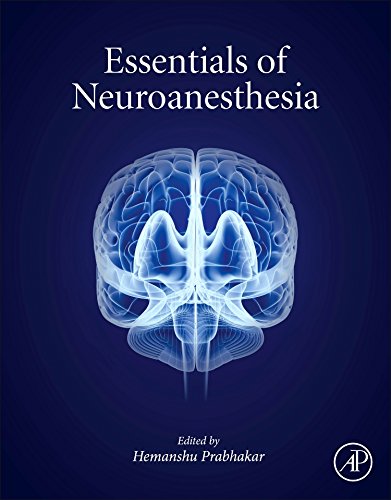Essentials of Neuroanesthesia 2017