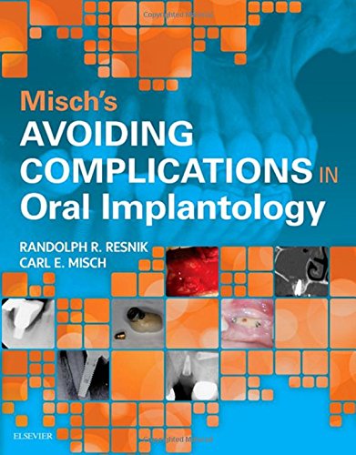 Misch's Avoiding Complications in Oral Implantology 2017