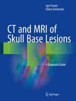 CT and MRI of Skull Base Lesions: A Diagnostic Guide 2018