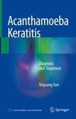 Acanthamoeba Keratitis: Diagnosis and Treatment 2018