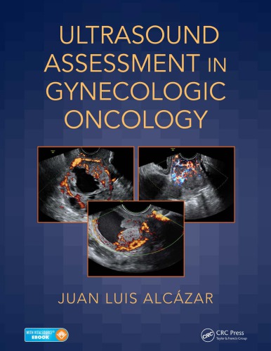 Ultrasound Assessment in Gynecologic Oncology 2018