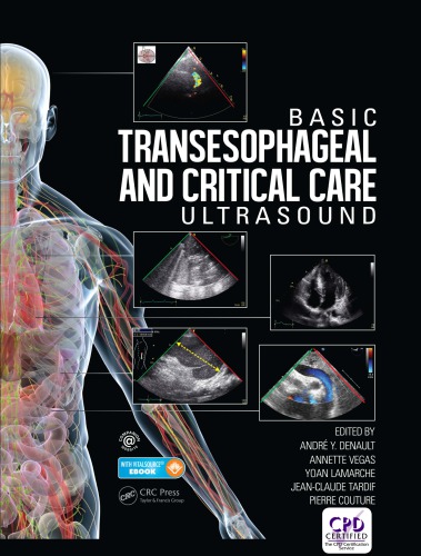 Basic Transesophageal and Critical Care Ultrasound 2017