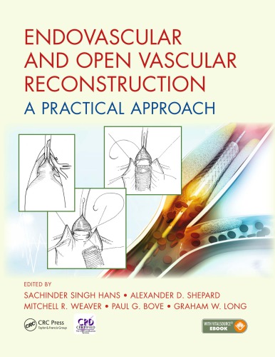 Endovascular and Open Vascular Reconstruction: A Practical Approach 2017