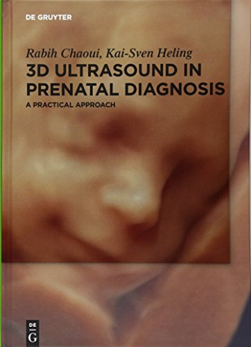3D Ultrasound in Prenatal Diagnosis: A Practical Approach 2016