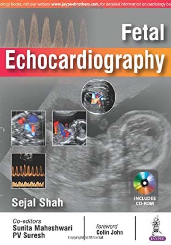 Fetal Echocardiography 2017