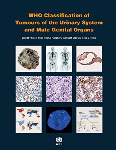 WHO Classification of Tumours of the Urinary System and Male Genital Organs 2016