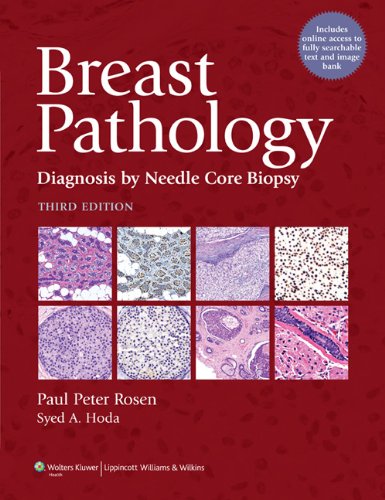 Breast Pathology: Diagnosis by Needle Core Biopsy 2010