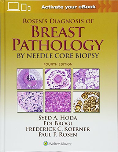 Rosen's Diagnosis of Breast Pathology by Needle Core Biopsy 2017