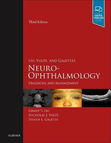 Liu, Volpe, and Galetta's Neuro-ophthalmology: Diagnosis and Management 2018